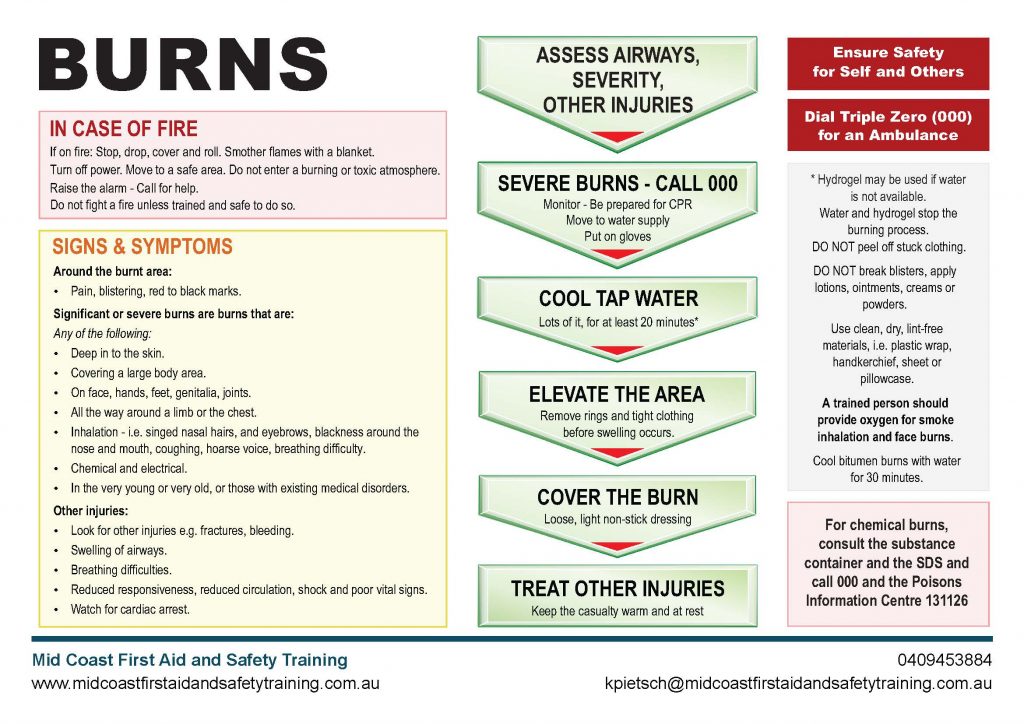 Burns Chart